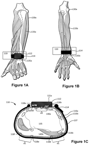 New Wristband Patent Cuts Noise in Muscle Signal Detection patent drawing, sheet 1