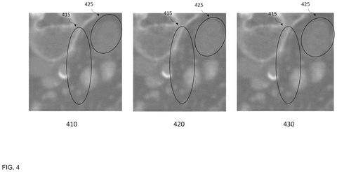 Nvidia Patents Software That Chooses How to Sharpen Your Blurry Images Faster patent drawing, sheet 4