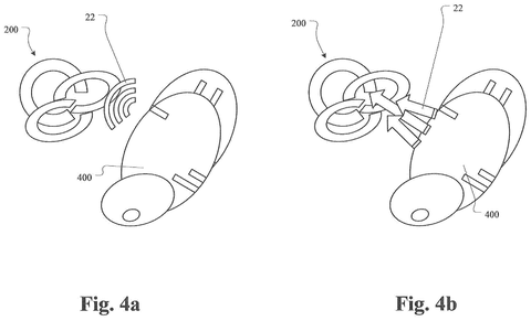 Direct stimulation of inner ear, drawing sheet 4 from US 2026/0233003 A1