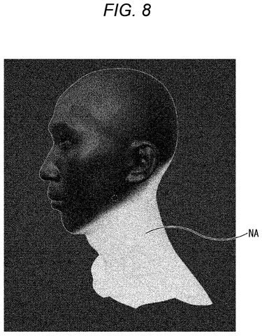 Highlighted neck region on a three-dimensional head model., drawing sheet 8 from US 2026/0237134 A1