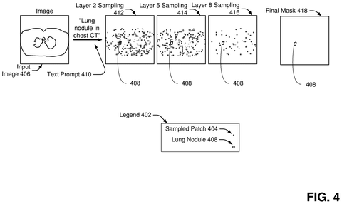 Progressive sampling and isolation of a lung nodule, drawing sheet 4 from US 2026/0253375 A1
