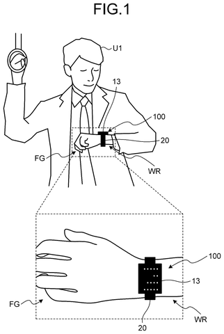 Wrist-mounted device on a person., drawing sheet 1 from US 2026/0277311 A1