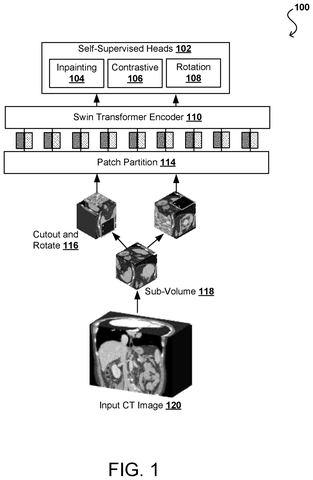AI system processing a CT image, drawing sheet 1 from US 2026/0278851 A1