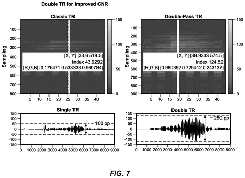 Signal-to-noise ratio comparison., drawing sheet 7 from US 2026/0301726 A1