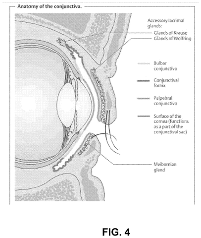 Cross section of eyelid anatomy, drawing sheet 4 from US 2026/0305985 A1
